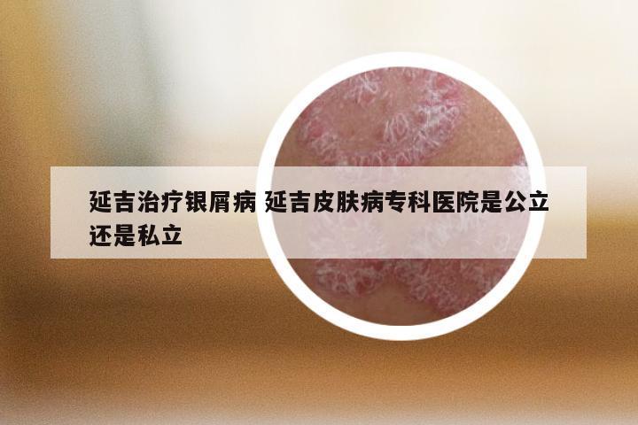 延吉治疗银屑病 延吉皮肤病专科医院是公立还是私立