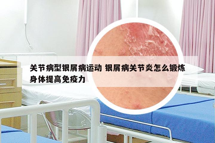 关节病型银屑病运动 银屑病关节炎怎么锻炼身体提高免疫力