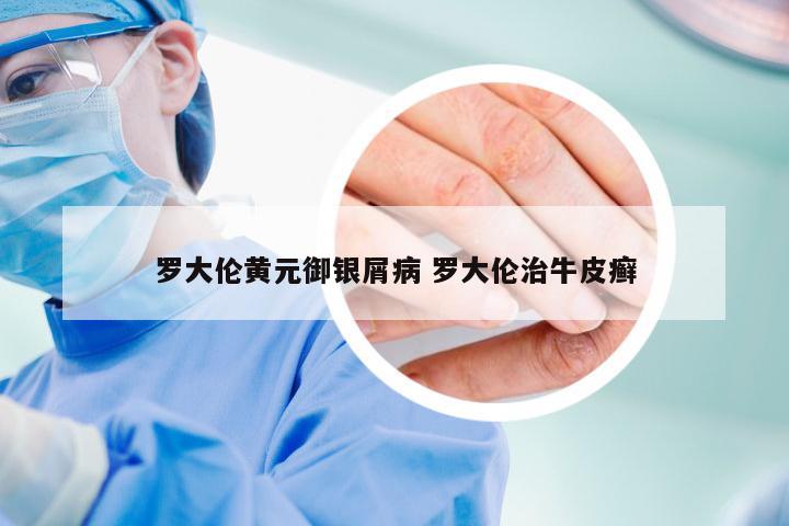 罗大伦黄元御银屑病 罗大伦治牛皮癣
