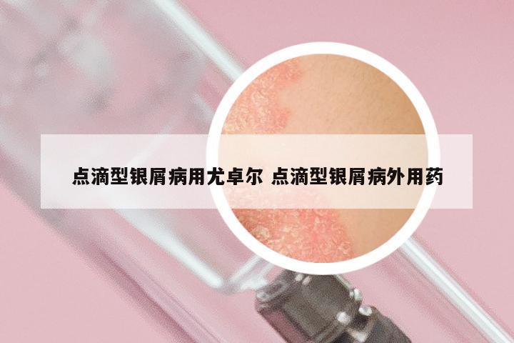 点滴型银屑病用尤卓尔 点滴型银屑病外用药