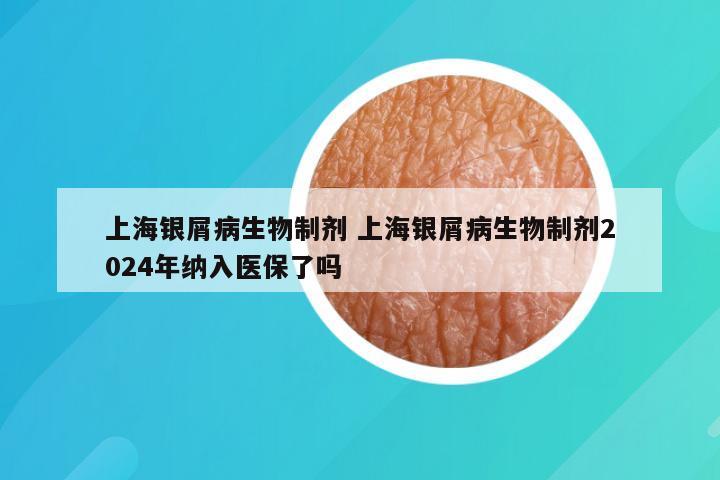 上海银屑病生物制剂 上海银屑病生物制剂2024年纳入医保了吗