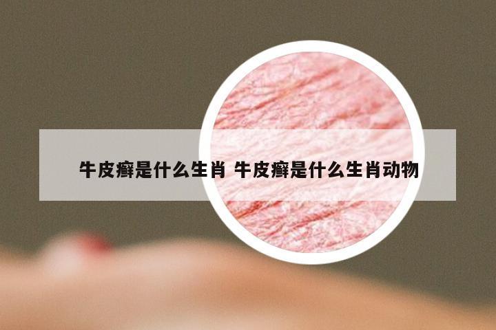 牛皮癣是什么生肖 牛皮癣是什么生肖动物