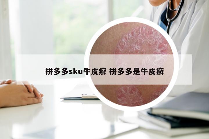 拼多多sku牛皮癣 拼多多是牛皮癣