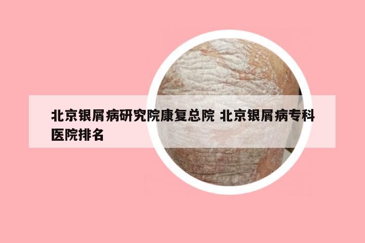 北京银屑病研究院康复总院 北京银屑病专科医院排名