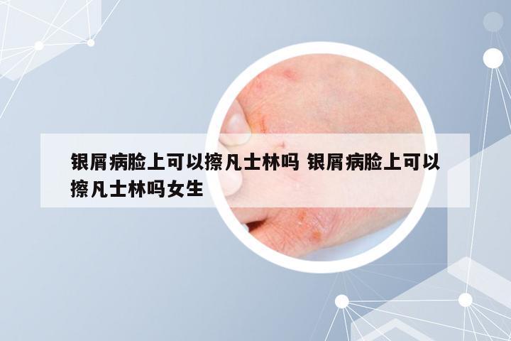 银屑病脸上可以擦凡士林吗 银屑病脸上可以擦凡士林吗女生