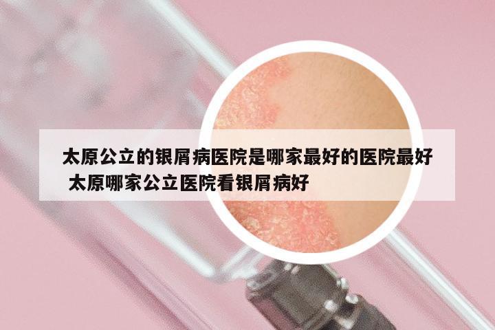 太原公立的银屑病医院是哪家最好的医院最好 太原哪家公立医院看银屑病好