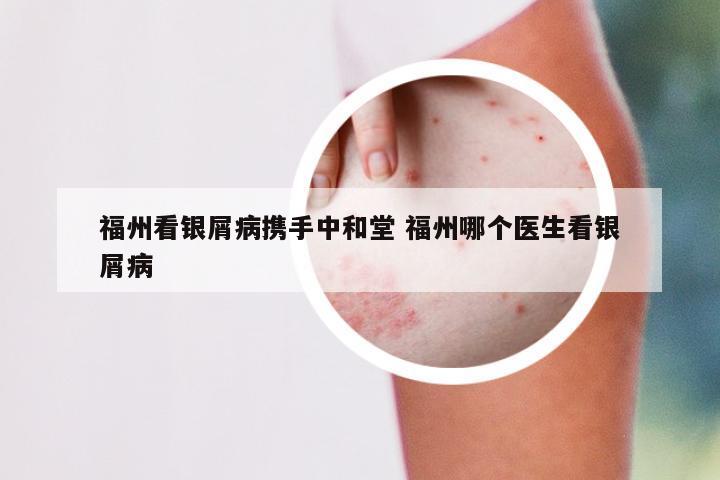 福州看银屑病携手中和堂 福州哪个医生看银屑病
