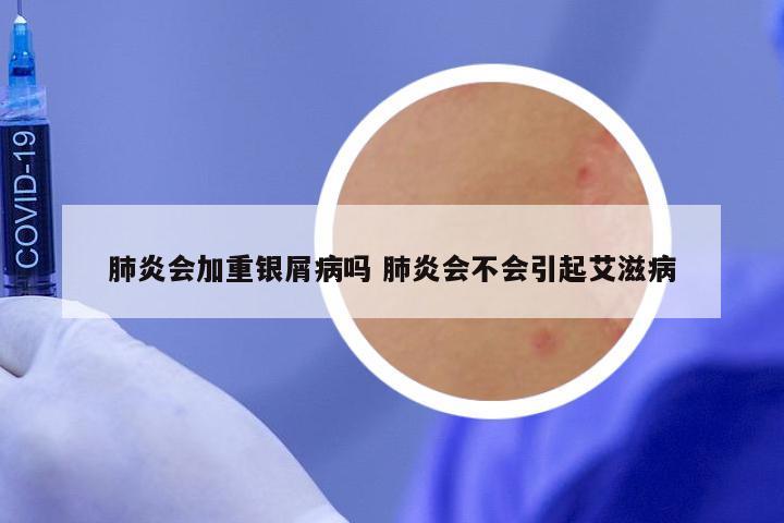 肺炎会加重银屑病吗 肺炎会不会引起艾滋病